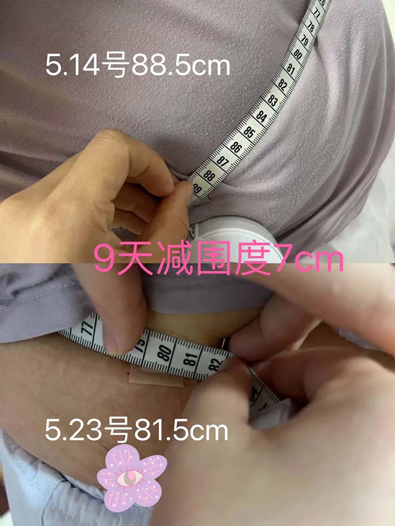 武汉顾连康复医院财务经理小亭子在展示医院中医减重成果